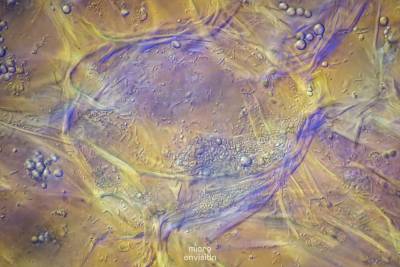 Sauerkraut cells with lactic acid bacteria