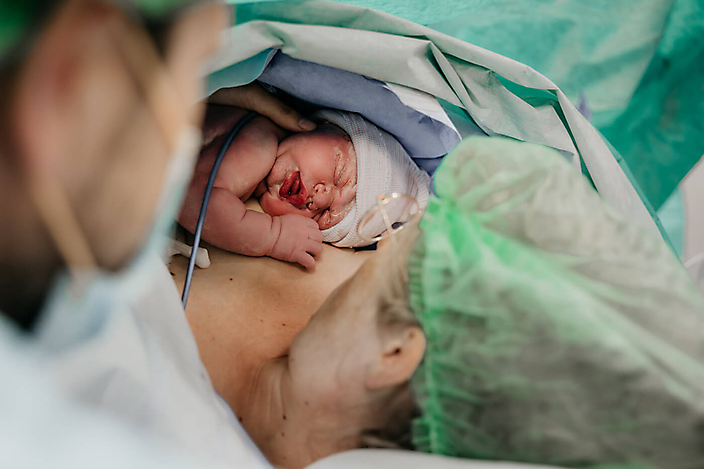 Geboortefotografie, geboorte, geboortefotograaf, bevalling, keizersnede 1 www.defotokundige.nl-2